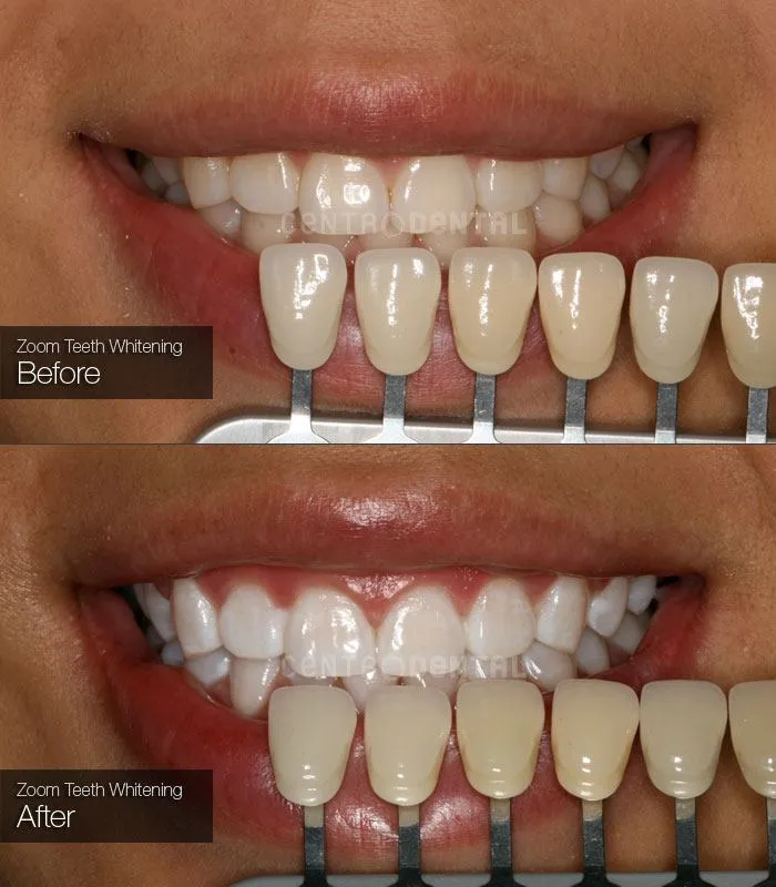 25893 dentist examining teeth