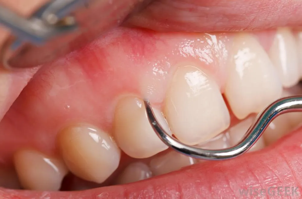 /img/25894-home-whitening-kits-8.webp