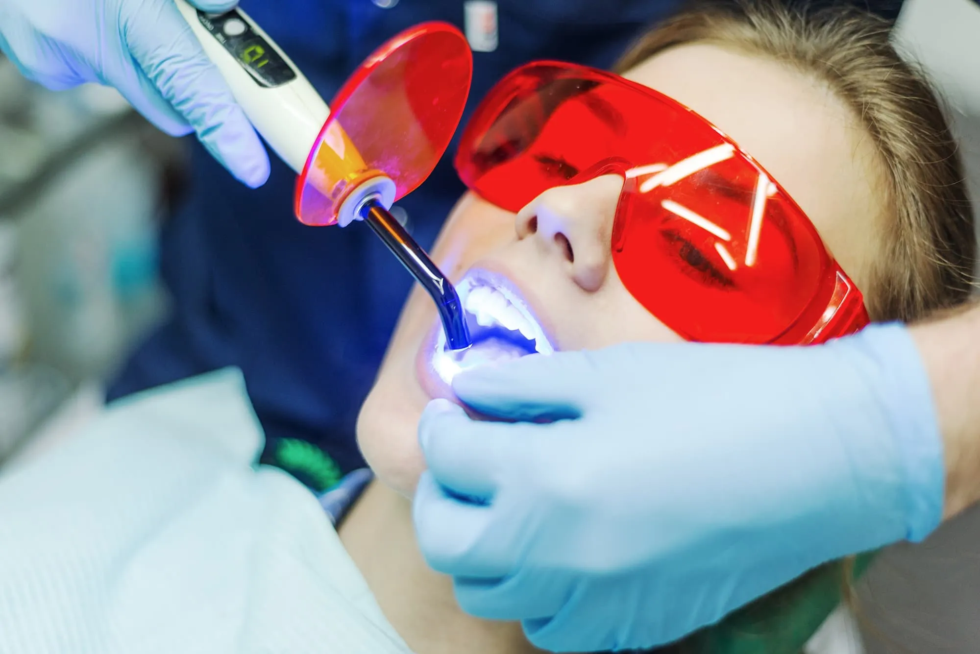 25899 teeth whitening consultation