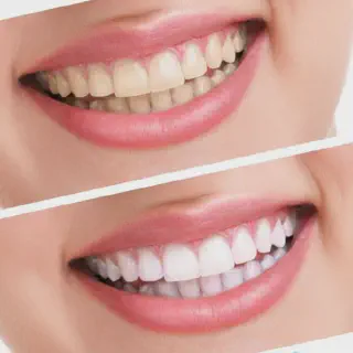 /img/25900-smile-makeover-los-angeles.webp