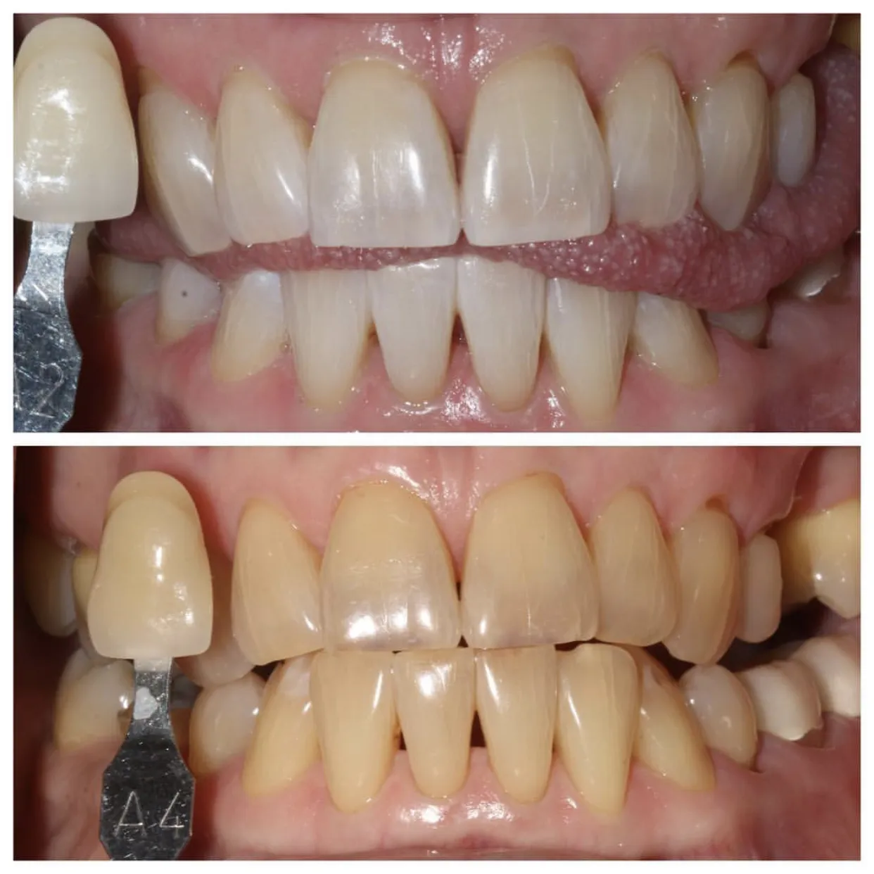 25908 zoom aftercare