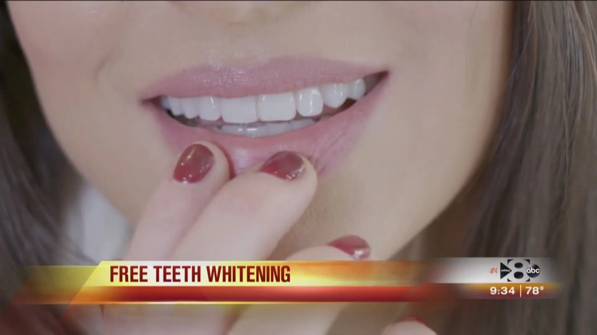 25910 mint dentistry free whitening process