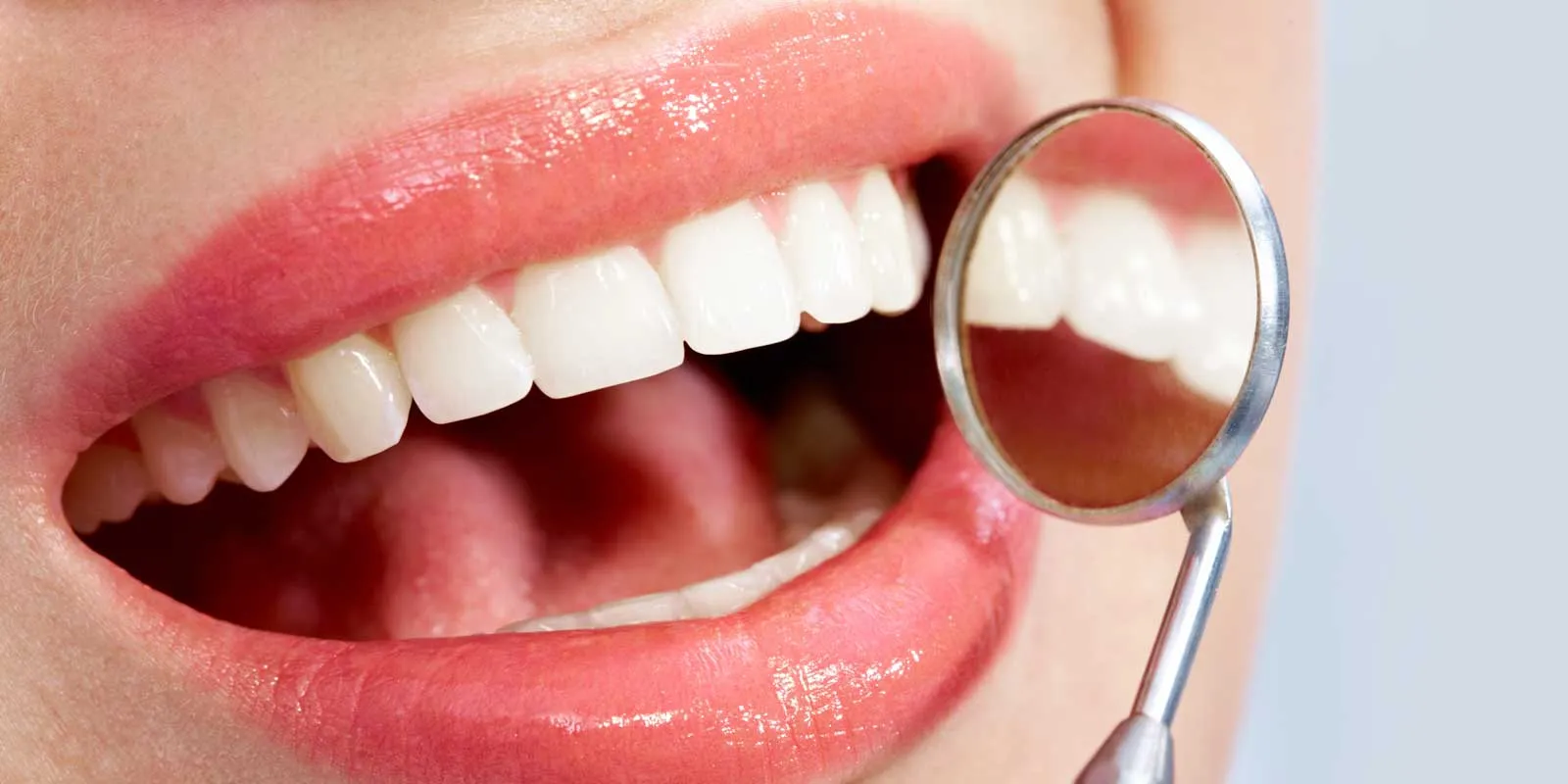 25916 over the counter whitening
