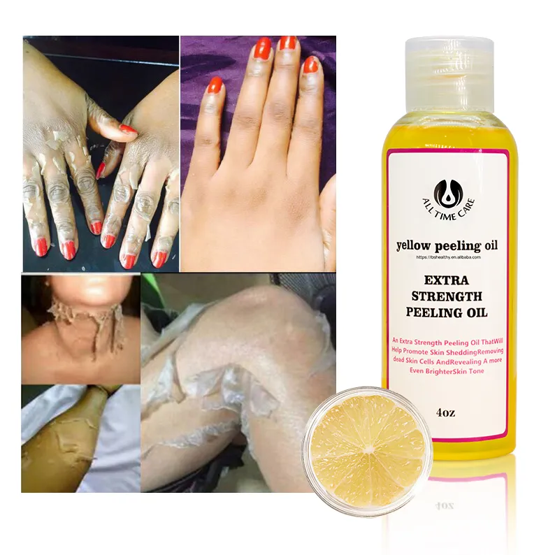 /img/25918-whitening-peeling-oil-chemical-peel.webp
