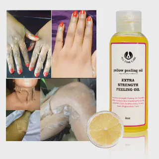 /img/25918-whitening-peeling-oil-chemical-peel.webp