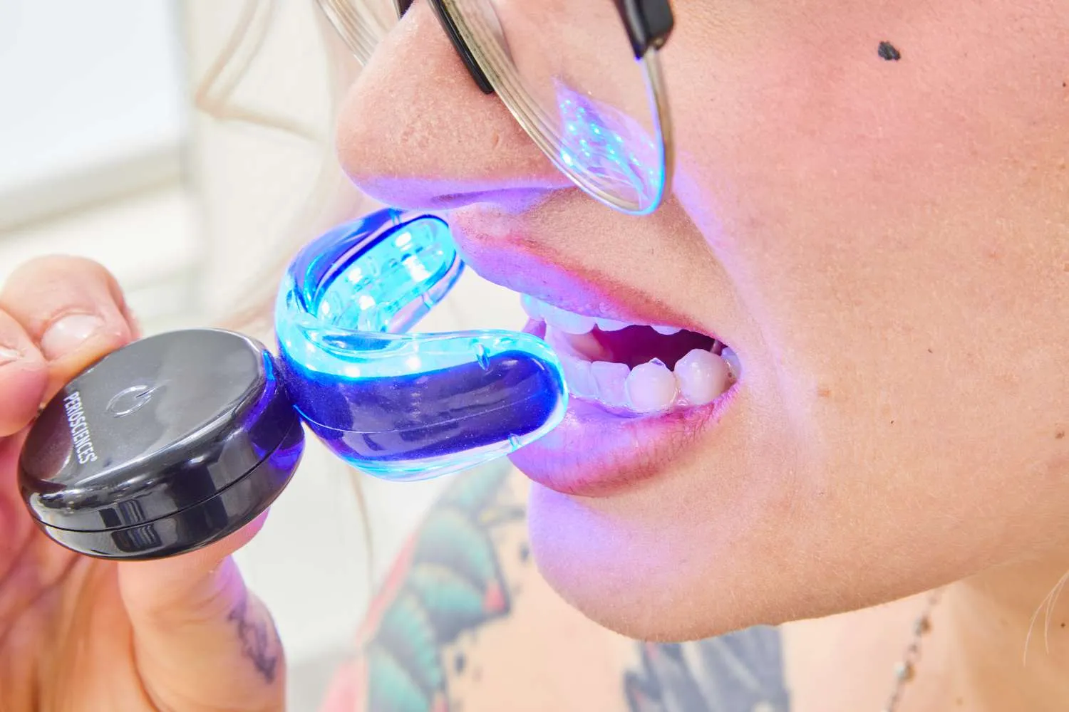 25926 at home teeth whitening