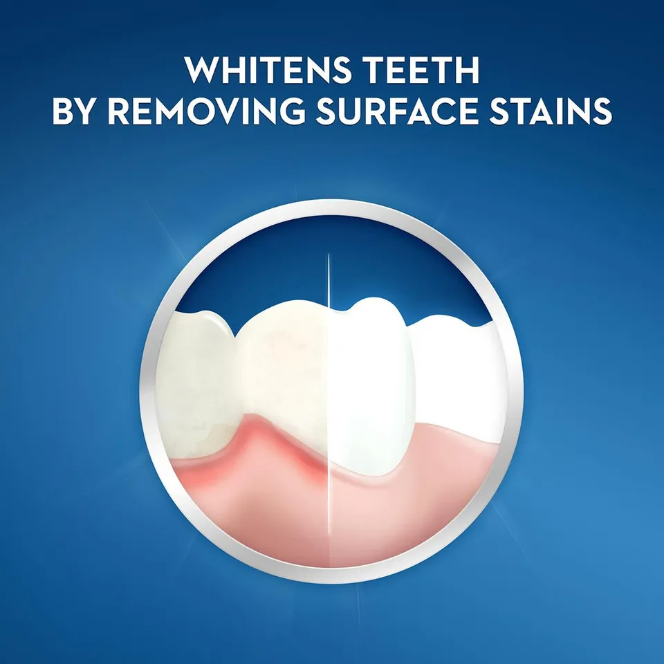 25931 teeth whitening alternative