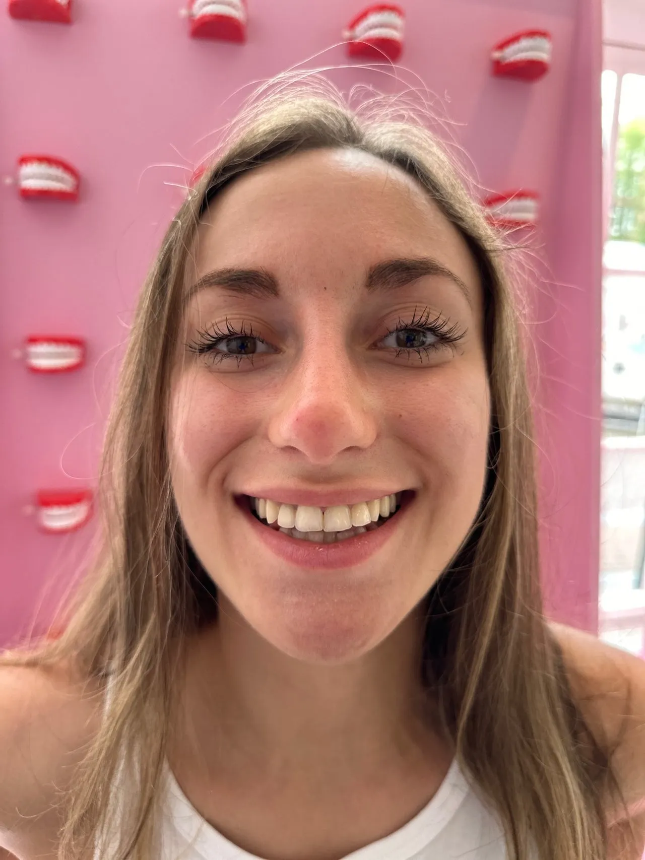 25932 teeth whitening cost comparison