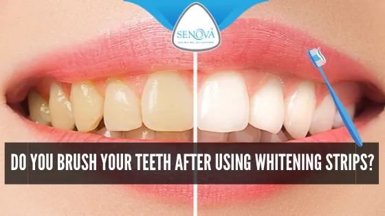 25933 sensitive teeth