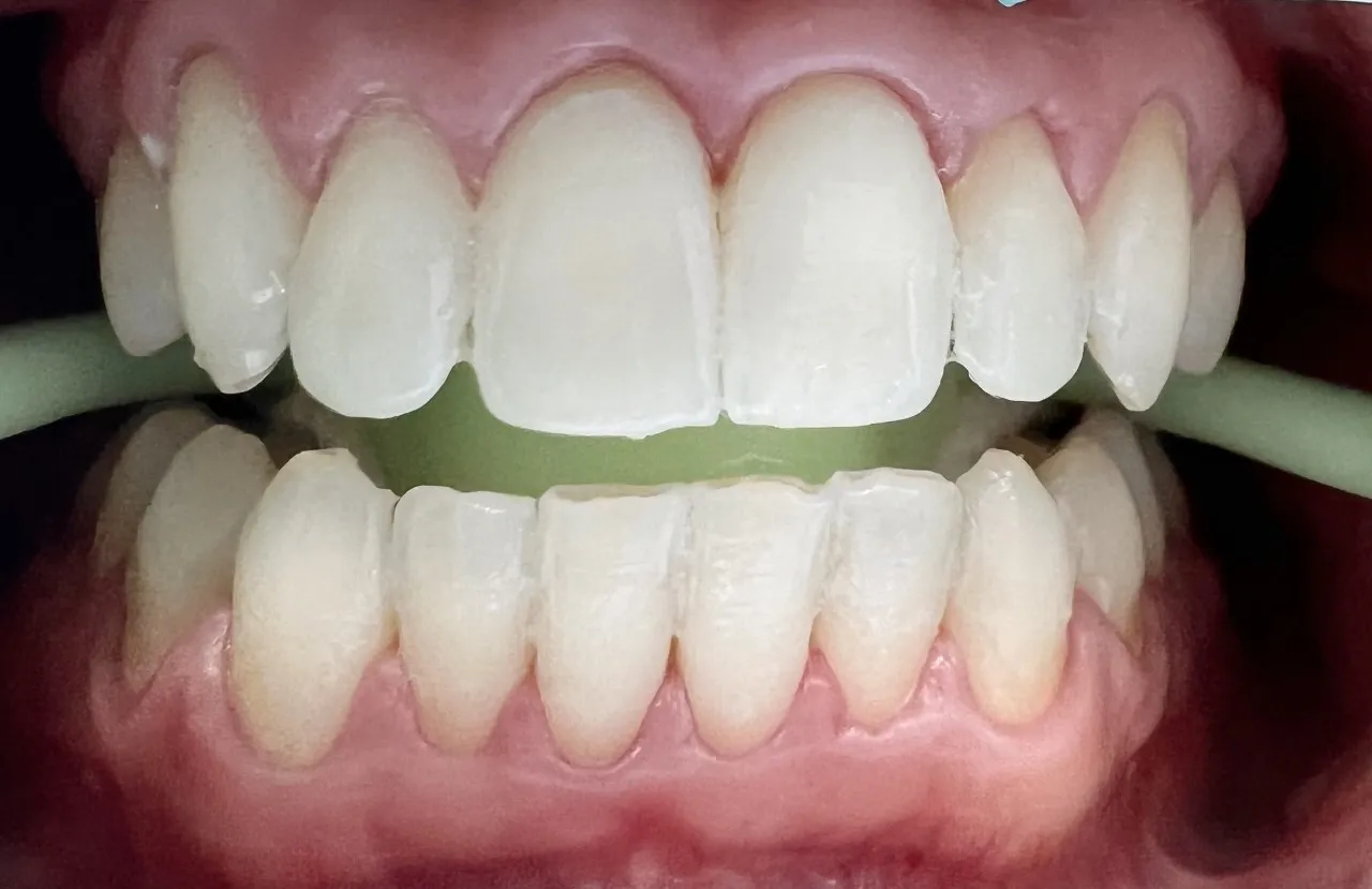 25934 youthful smile