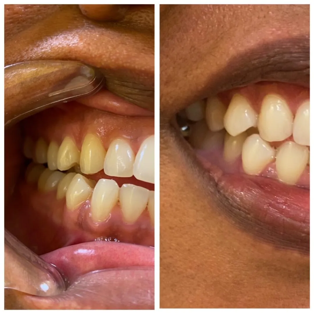 25937 buckhead dentist teeth whitening