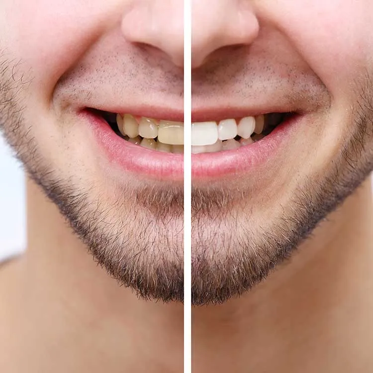 25945 avoid staining foods