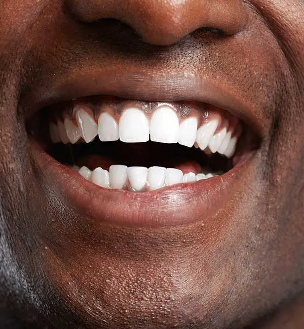 25945 healthy smile