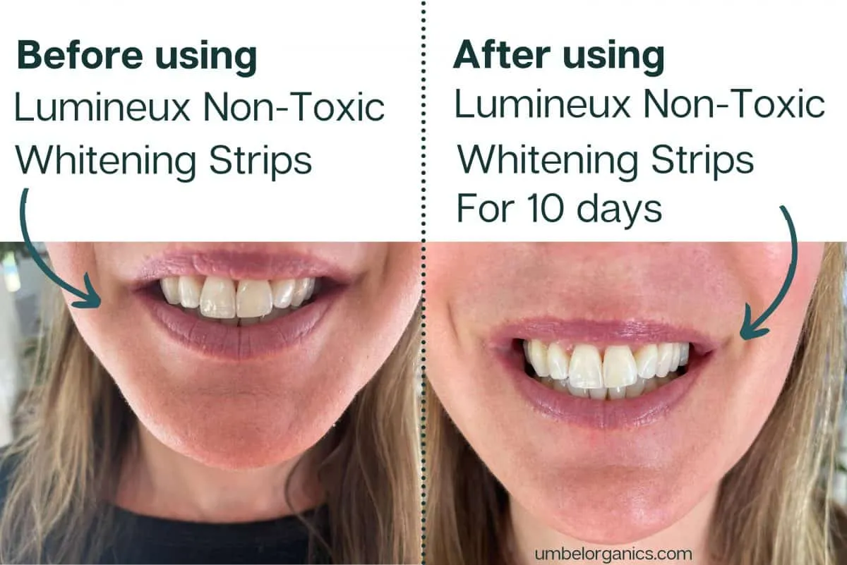/img/25953-teeth-whitening-tips.webp