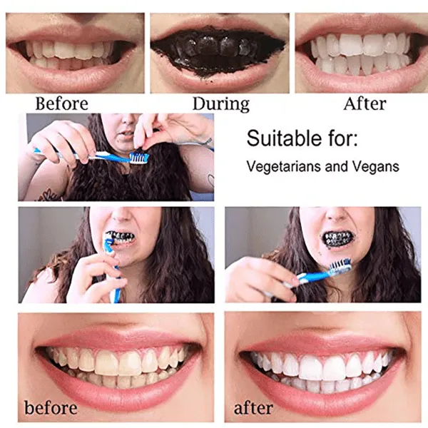 25963 dental checkup