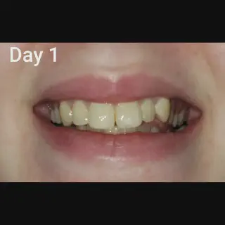 /img/25963-oral-hygiene.webp