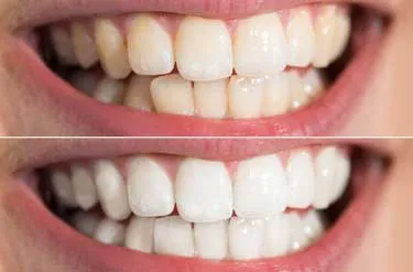 25967 confident smile