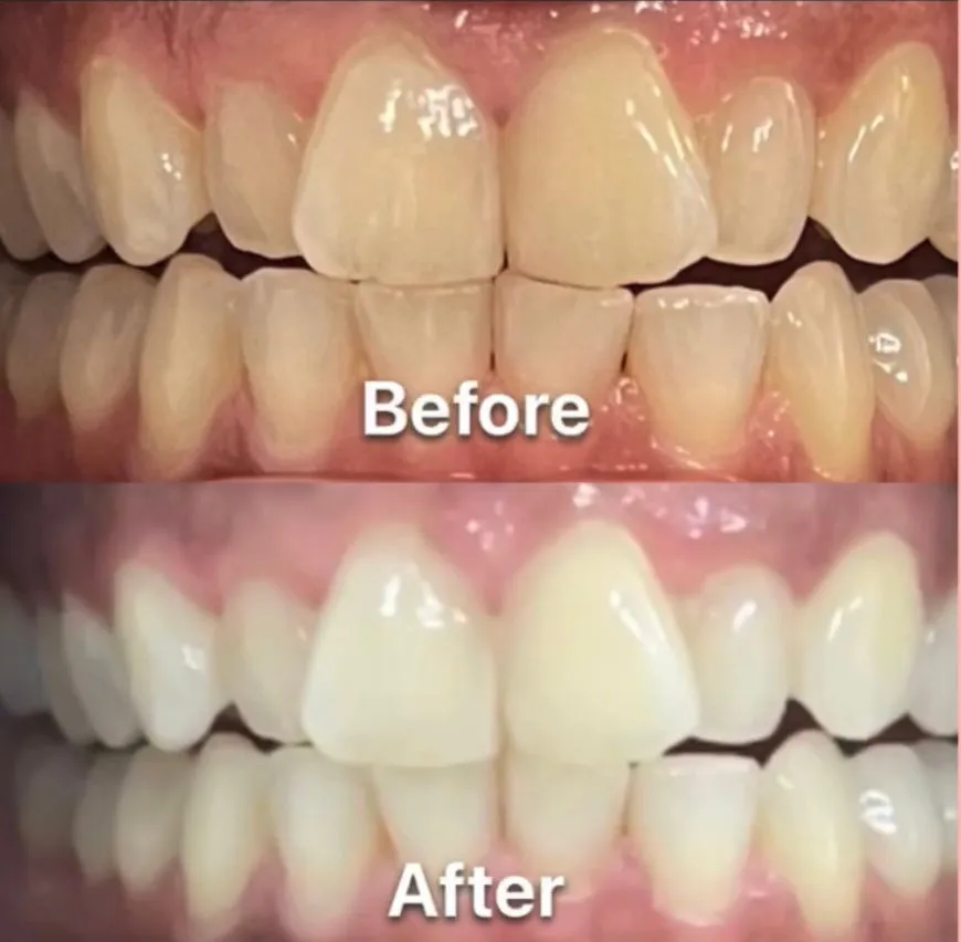 /img/25967-dental-checkup.webp