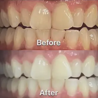 /img/25967-dental-checkup.webp
