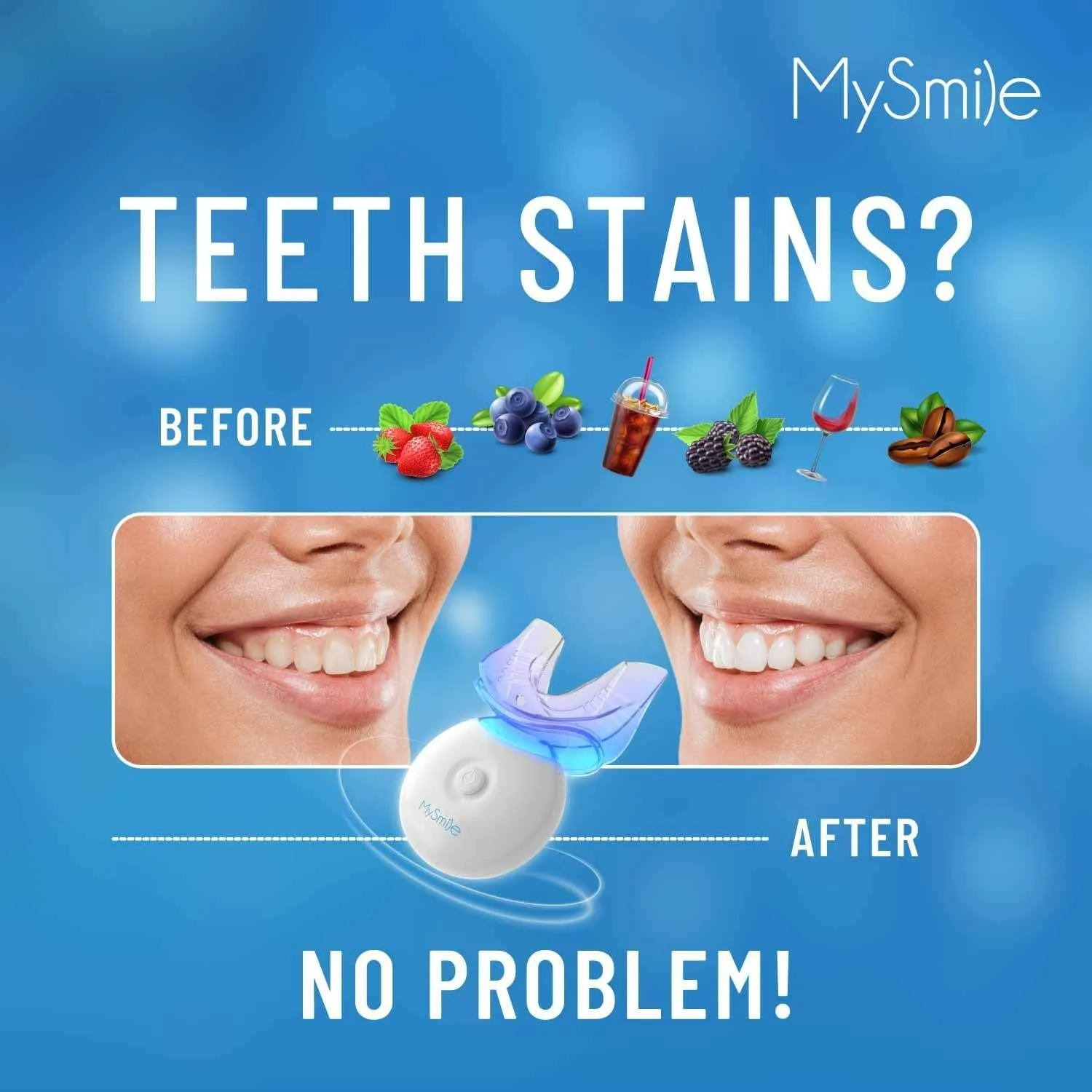 25969 teeth whitening options