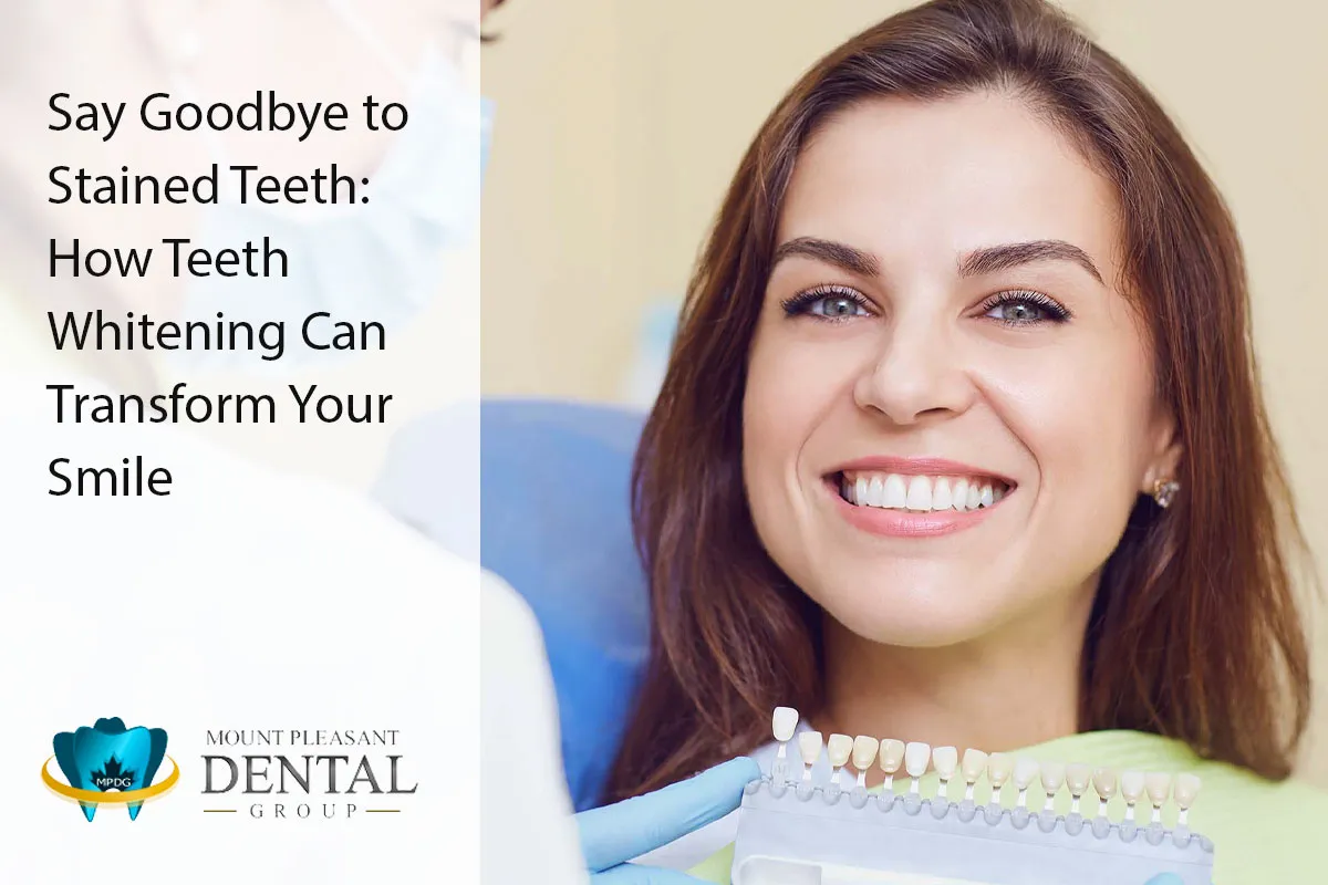 25972 teeth whitening mount pleasant 7
