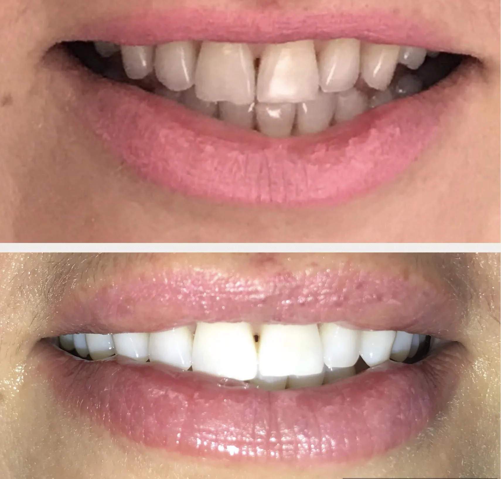 /img/25972-teeth-whitening-mount-pleasant-8.webp