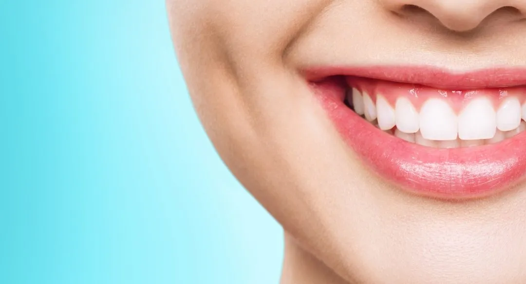 25973 professional teeth whitening