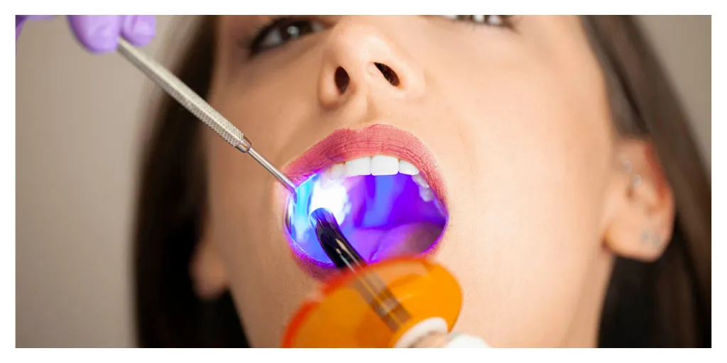 25973 teeth whitening results