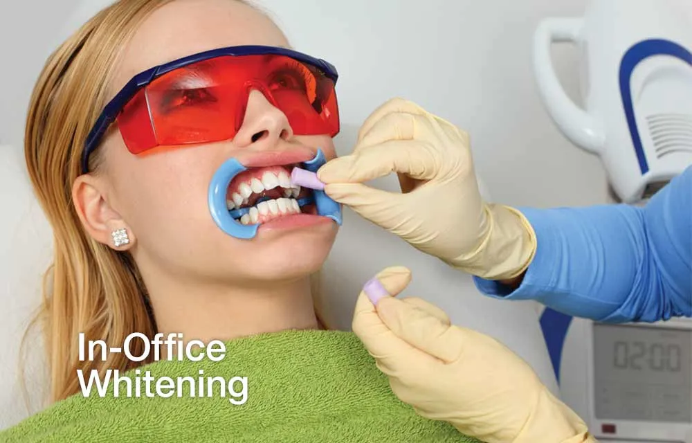 25974 foil whitening pros cons