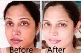 /img/25976-alternative-skin-whitening.webp