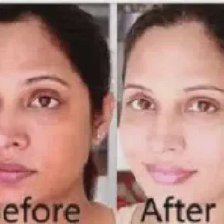 /img/25976-alternative-skin-whitening.webp