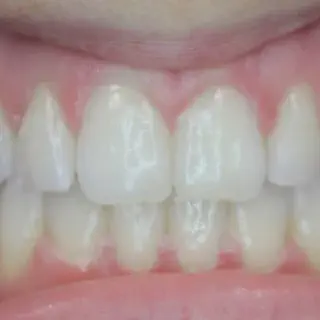 /img/25977-dental-consultation.webp