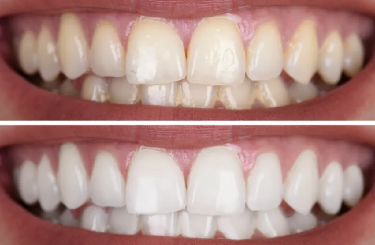 25977 smiling woman