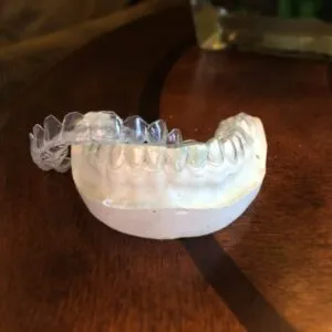 25982 teeth whitening columbia sc image4