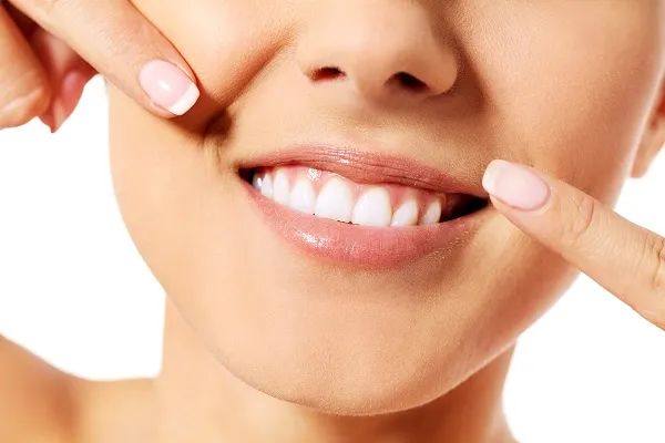 25982 teeth whitening columbia sc image6