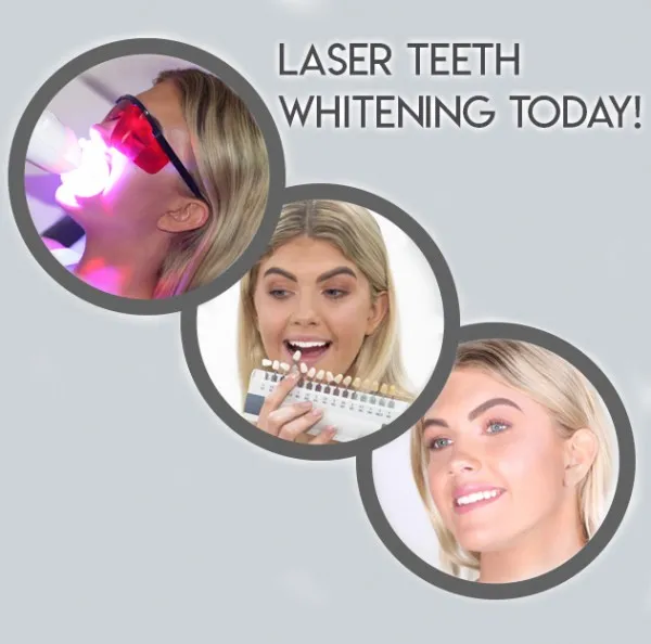 25985 at home whitening