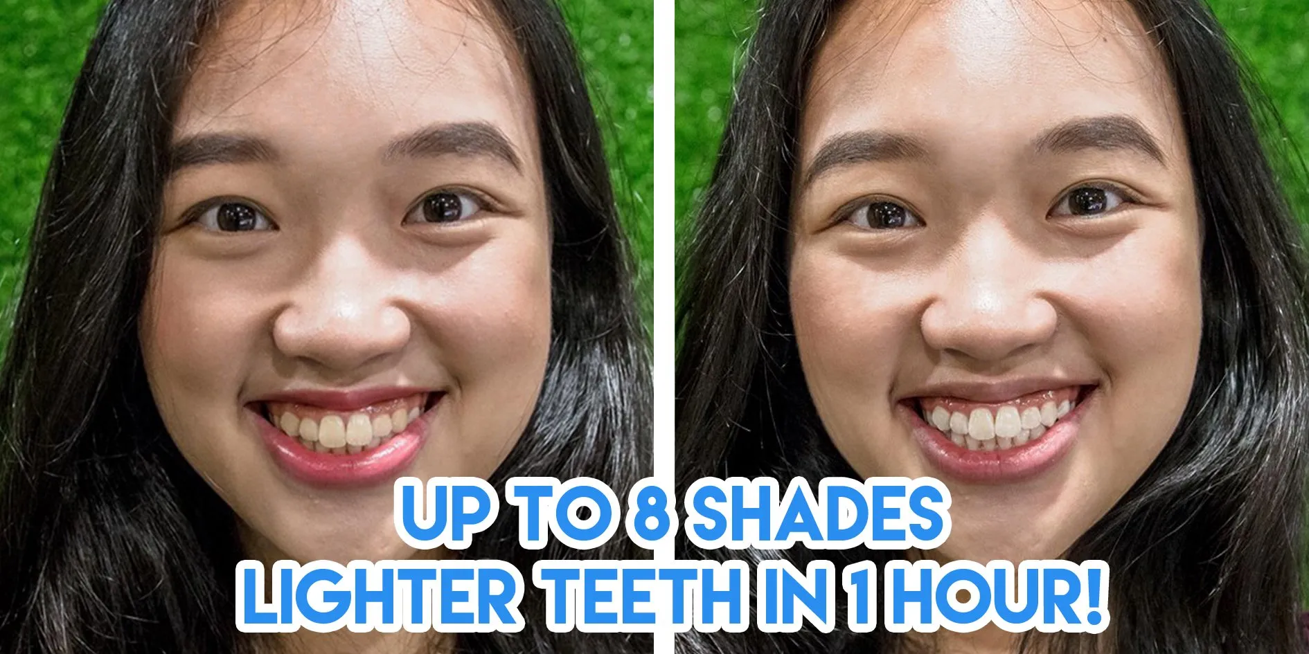 25986 teeth whitening deal 1