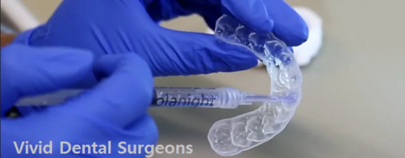 25986 types of teeth whitening