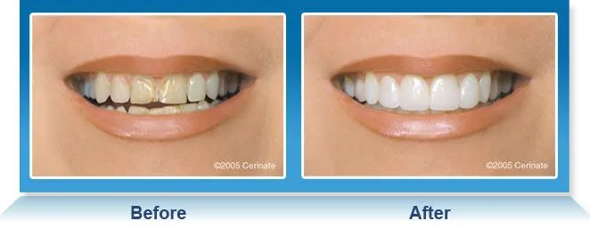 25991 dentist consultation fresno