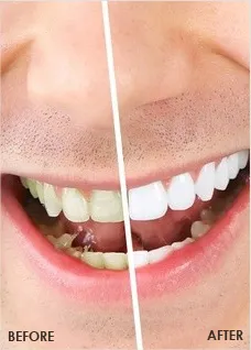 25991 teeth brushing flossing