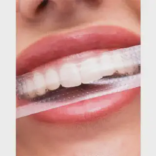 /img/25993-post-whitening-care.webp