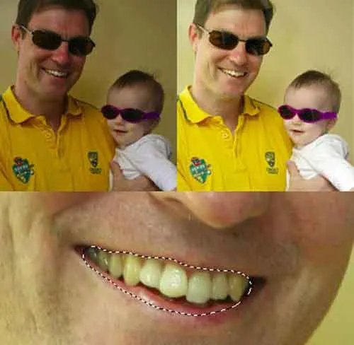 25995 teeth selection tool