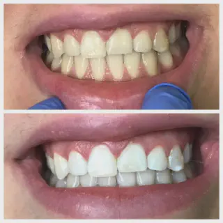 /img/25998-dental-hygiene.webp