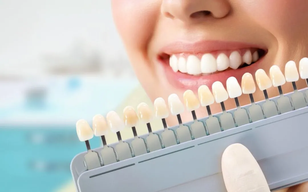 /img/26001-maintaining-teeth-whitening.webp