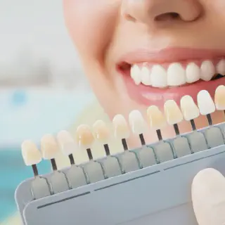 /img/26001-maintaining-teeth-whitening.webp