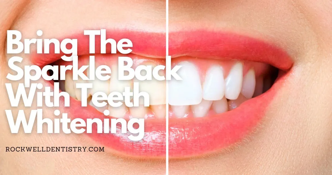 26018 take home teeth whitening kit