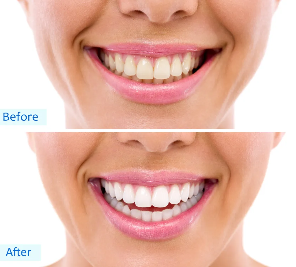 26025 dentist consultation