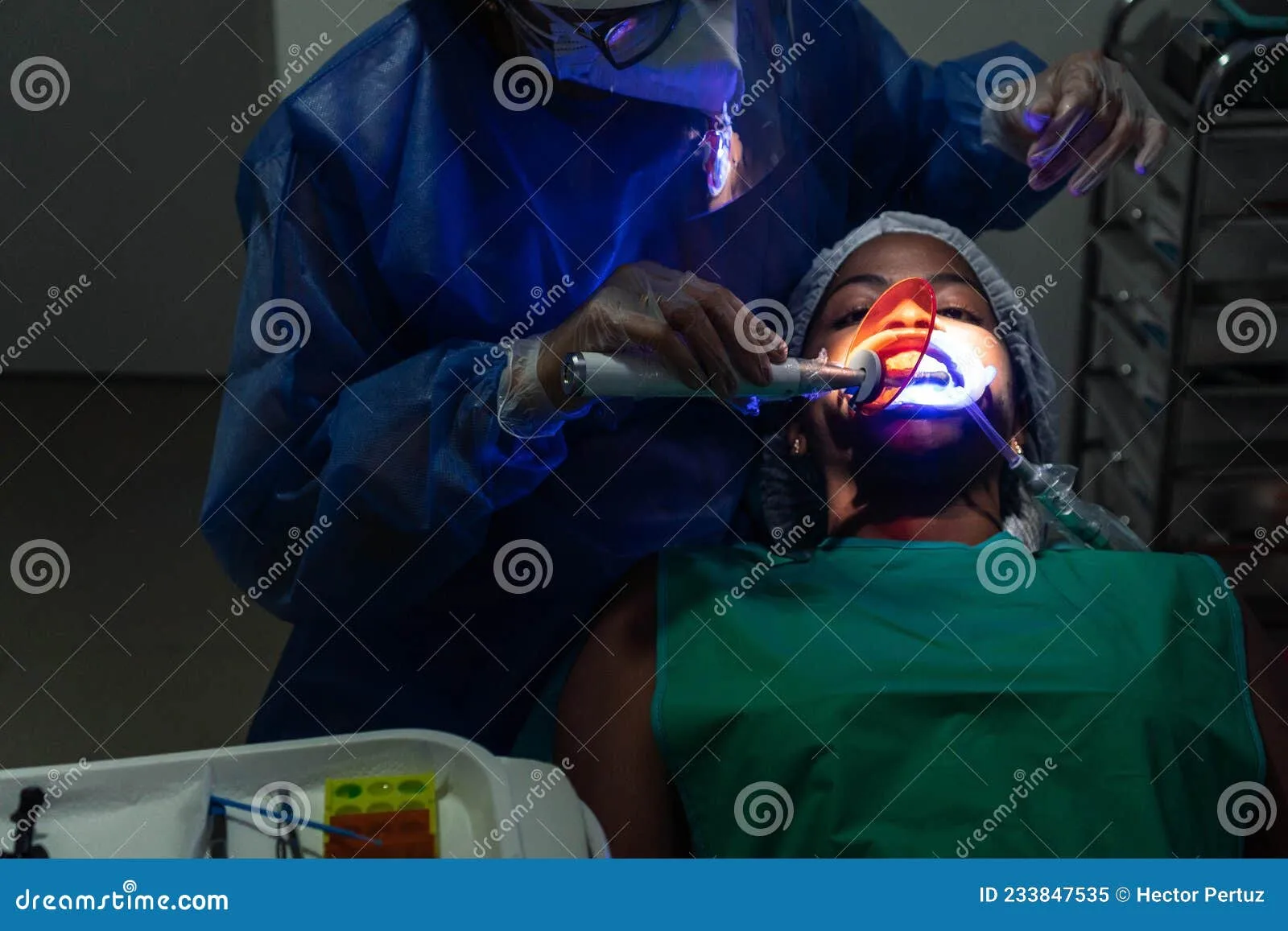 26025 in office whitening