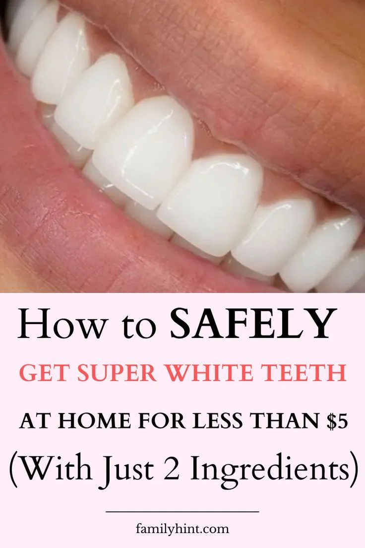 /img/26026-dental-checkup.webp
