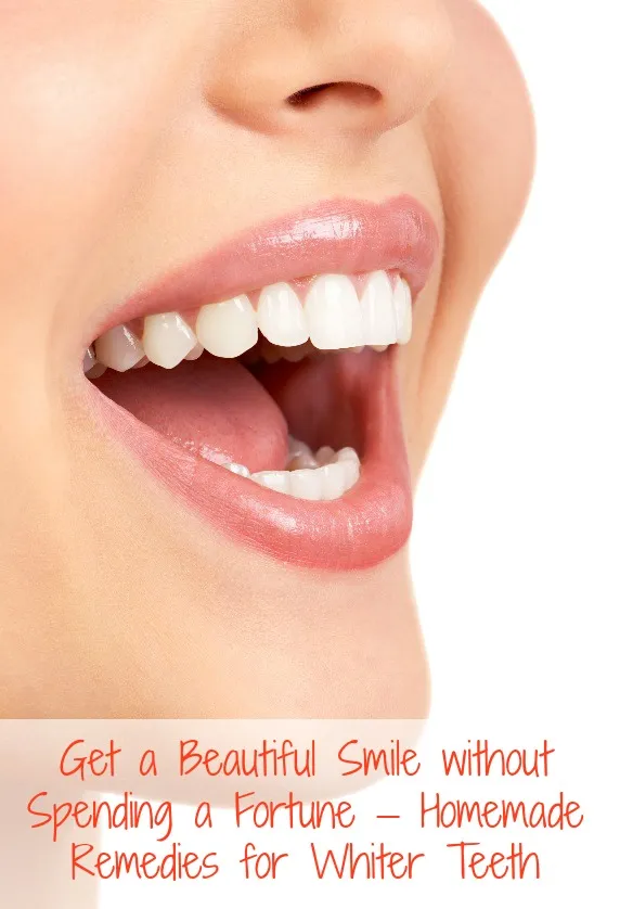 26026 foods staining teeth